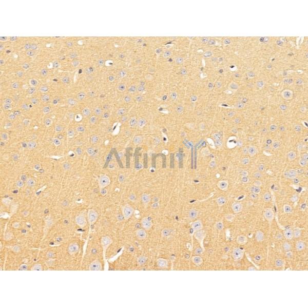 SLC16A8 Antibody - DF13644 at 1/100 staining Mouse brain tissue by IHC-P.