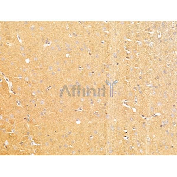 SLC16A8 Antibody - DF13644 at 1/100 staining Rat brain tissue by IHC-P.