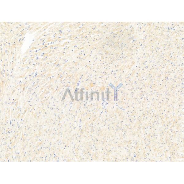 Mov10 Antibody - DF13651 at 1/100 staining Rat heart tissue by IHC-P.