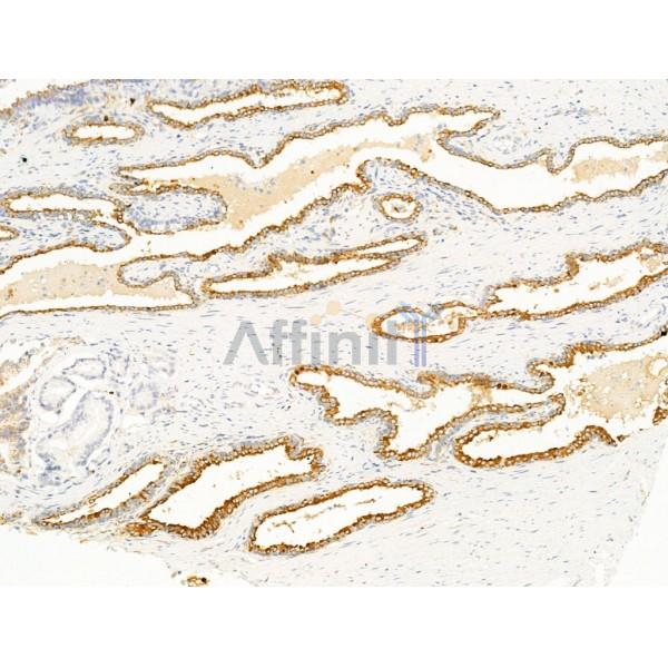 Argonaute 4 Antibody - DF13656 at 1/100 staining Mouse heart tissue by IHC-P.