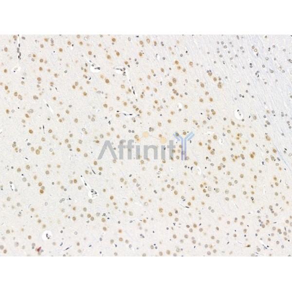 RECQL5 Antibody - DF13664 at 1/100 staining Rat brain tissue by IHC-P.