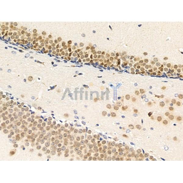RECQL5 Antibody - DF13664 at 1/100 staining Mouse brain tissue by IHC-P.