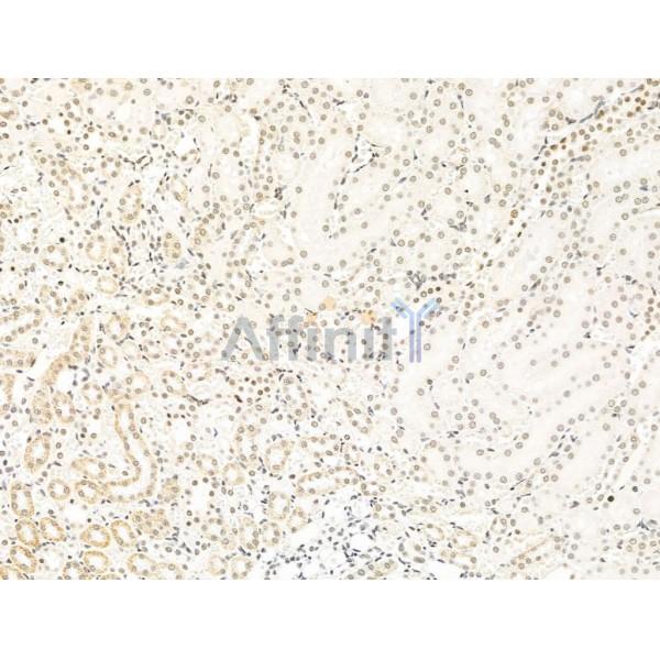 RECQL5 Antibody - DF13664 at 1/100 staining Rat kidney tissue by IHC-P.
