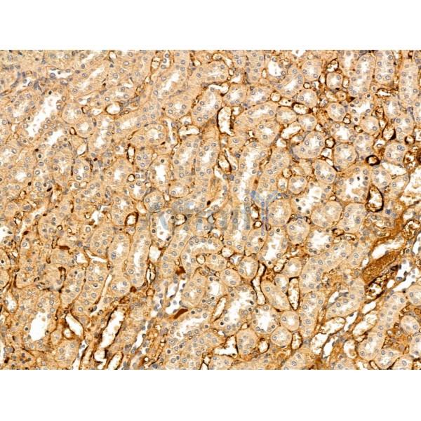 VLDL Receptor Antibody - DF13667 at 1/100 staining Rat kidney tissue by IHC-P.