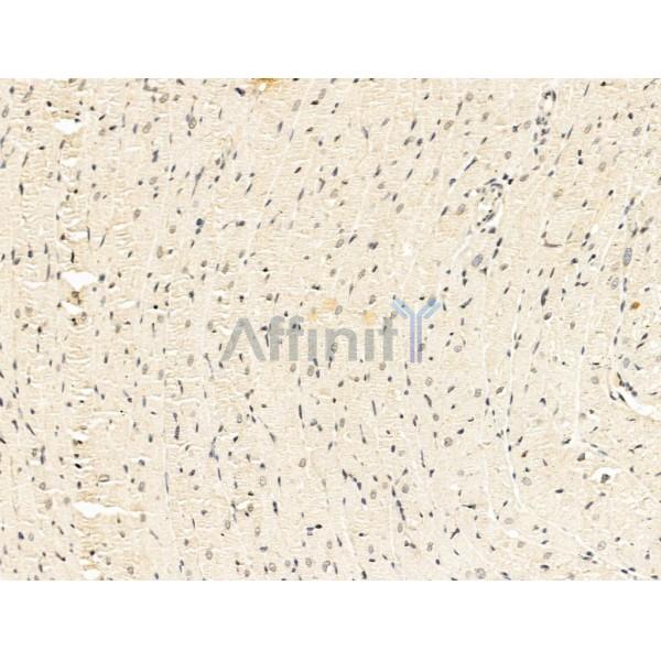 TACC2 Antibody - DF13674 at 1/100 staining Rat heart tissue by IHC-P.