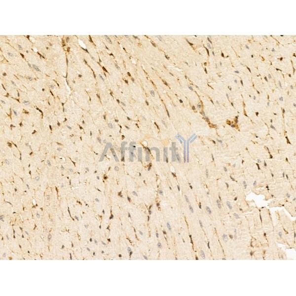 TACC2 Antibody - DF13674 at 1/100 staining Mouse heart tissue by IHC-P.