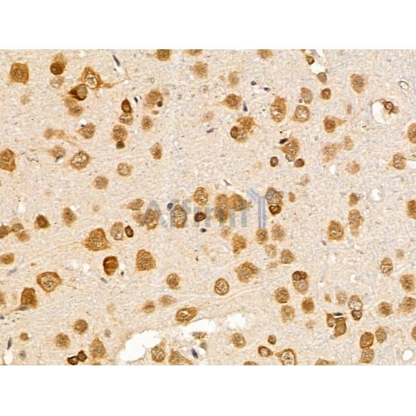 SDCCAG3 Antibody - DF13676 at 1/100 staining Rat brain tissue by IHC-P.