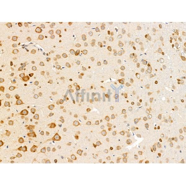 Olfactory Marker Protein Antibody - DF13678 at 1/100 staining Rat brain tissue by IHC-P.