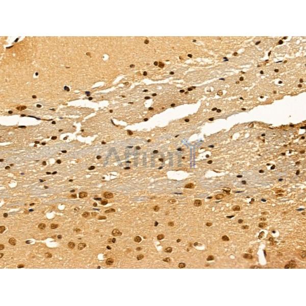 Importin 7 Antibody - DF13679 at 1/100 staining Mouse brain tissue by IHC-P.