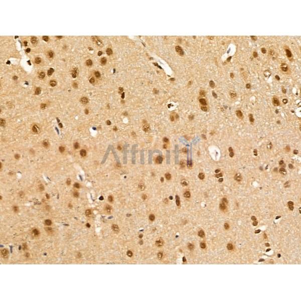 Importin 7 Antibody - DF13679 at 1/100 staining Rat brain tissue by IHC-P.