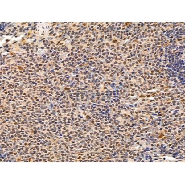 Importin 7 Antibody - DF13679 at 1/100 staining Rat spleen tissue by IHC-P.