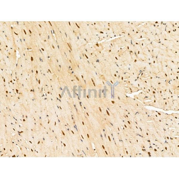 Importin 7 Antibody - DF13679 at 1/100 staining Mouse pancreatic tissue by IHC-P.