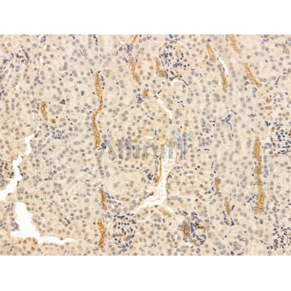 Chordin Antibody - DF13681 at 1/100 staining Mouse kidney tissue by IHC-P.