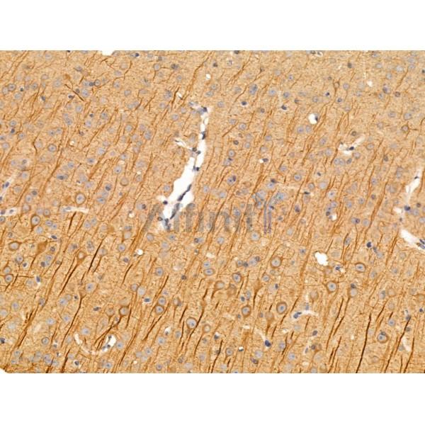 Chordin Antibody - DF13681 at 1/100 staining Mouse brain tissue by IHC-P.