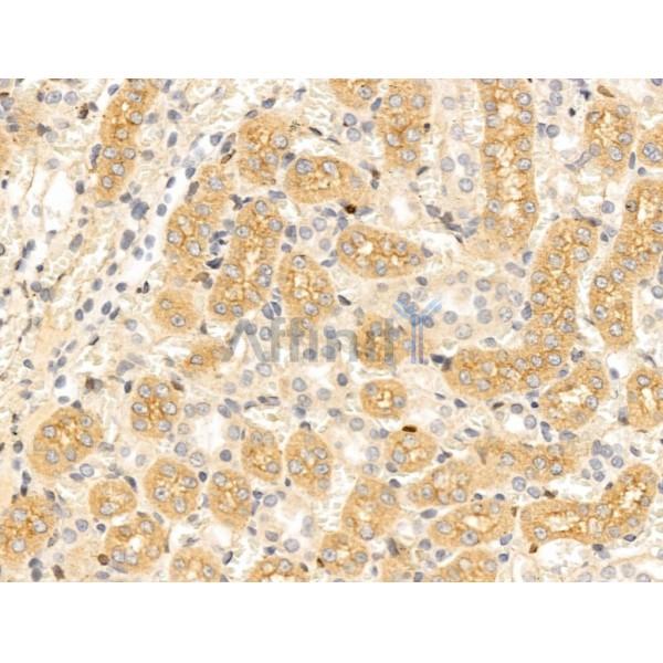 Chordin Antibody - DF13681 at 1/100 staining Rat kidney tissue by IHC-P.