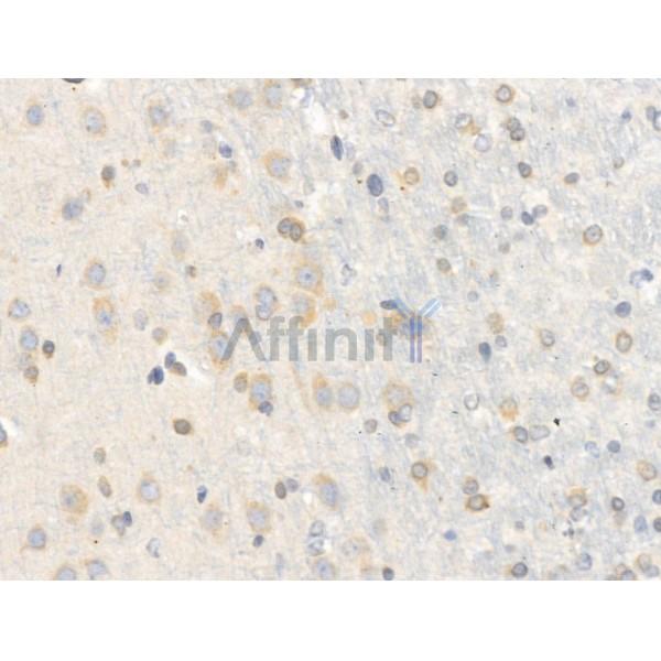 Chordin Antibody - DF13681 at 1/100 staining Rat brain tissue by IHC-P.