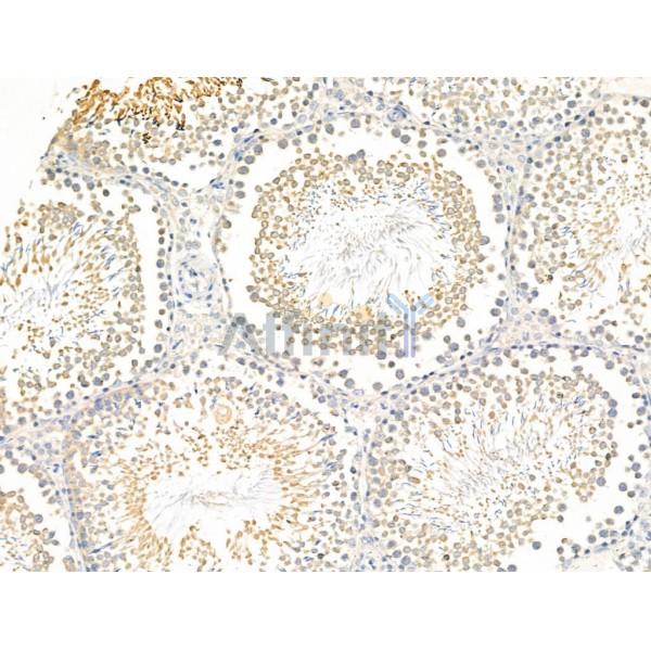 Zfp281 Antibody - DF13689 at 1/100 staining Rat testis tissue by IHC-P.