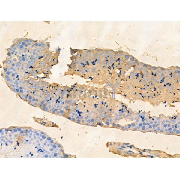 PHF20L1 Antibody - DF13692 at 1/100 staining Mouse testis tissue by IHC-P.