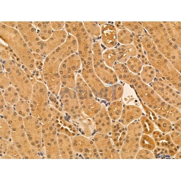 PHF20L1 Antibody - DF13692 at 1/100 staining Mouse kidney tissue by IHC-P.
