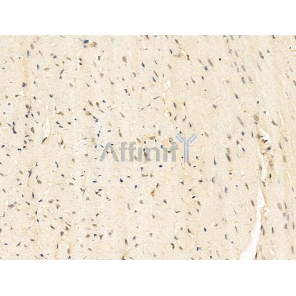 SNRNP200 Antibody - DF13693 at 1/100 staining Mouse heart tissue by IHC-P.
