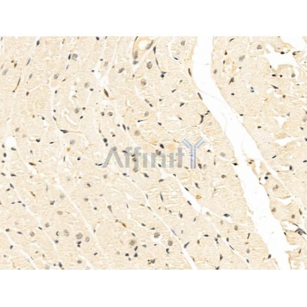SNRNP200 Antibody - DF13693 at 1/100 staining Rat heart tissue by IHC-P.