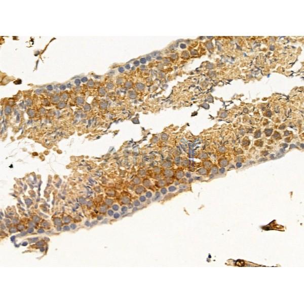 CCDC34 Antibody - DF13697 at 1/100 staining Mouse testis tissue by IHC-P.
