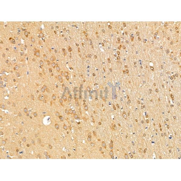 EB3 Antibody - DF13698 at 1/100 staining Rat brain tissue by IHC-P.