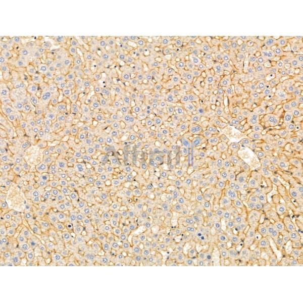 DERL2 Antibody - DF13711 at 1/100 staining Rat liver tissue by IHC-P.