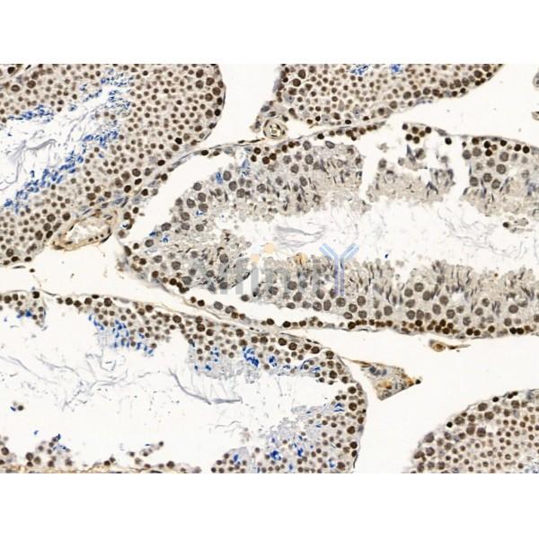 CCDC28A Antibody - DF13712 at 1/100 staining Mouse testis tissue by IHC-P.