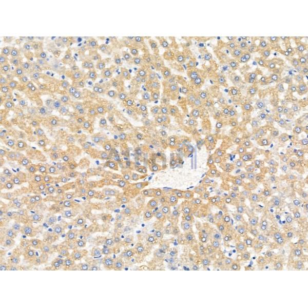 Methylmalonyl Coenzyme A mutase Antibody - DF13718 at 1/100 staining Rat liver tissue by IHC-P.
