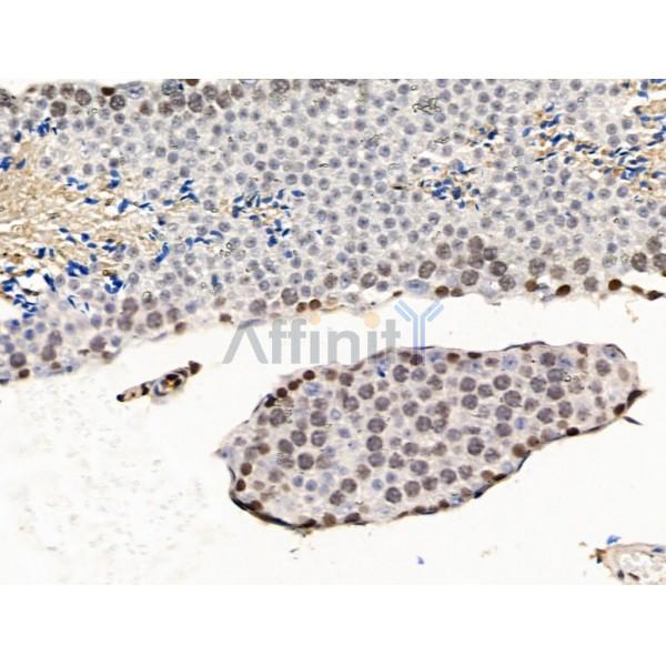 UXT Antibody - DF13721 at 1/100 staining Mouse testis tissue by IHC-P.