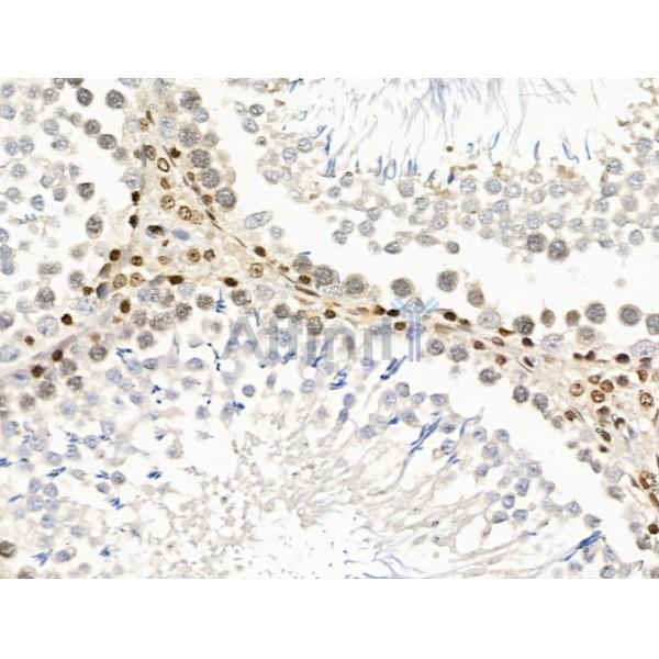 UXT Antibody - DF13721 at 1/100 staining Rat testis tissue by IHC-P.
