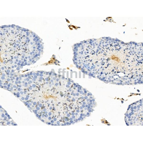 BAGE2 Antibody - DF13724 at 1/100 staining Mouse testis tissue by IHC-P.