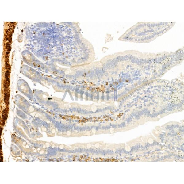 TTC7A Antibody - DF13728 at 1/100 staining Mouse colorectal tissue by IHC-P.