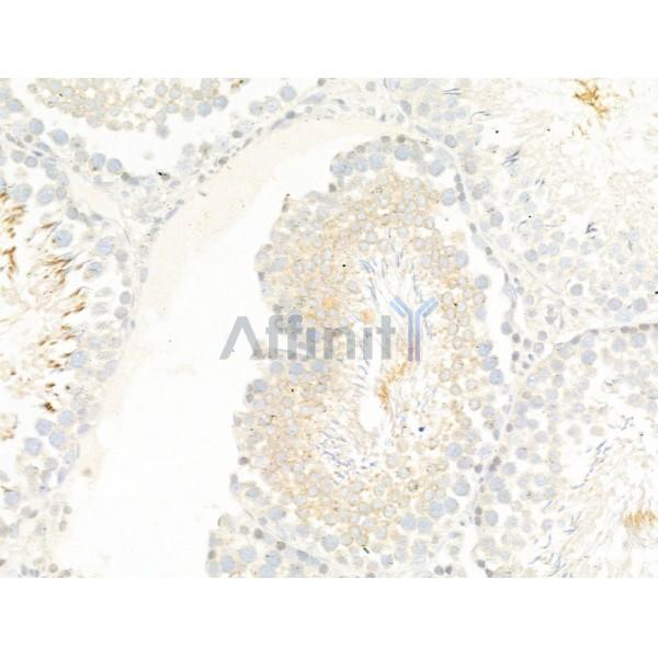 TTC7A Antibody - DF13728 at 1/100 staining Rat testis tissue by IHC-P.