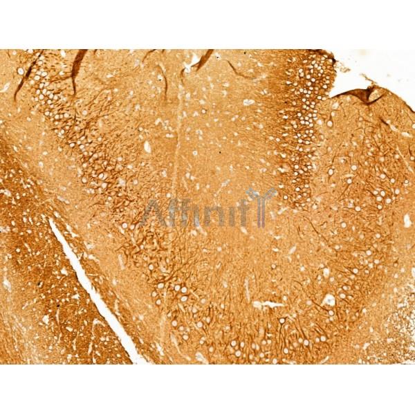 TTC7A Antibody - DF13728 at 1/100 staining Rat brain tissue by IHC-P.