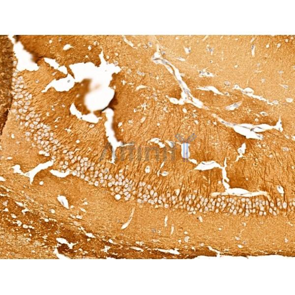 TTC7A Antibody - DF13728 at 1/100 staining Mouse brain tissue by IHC-P.