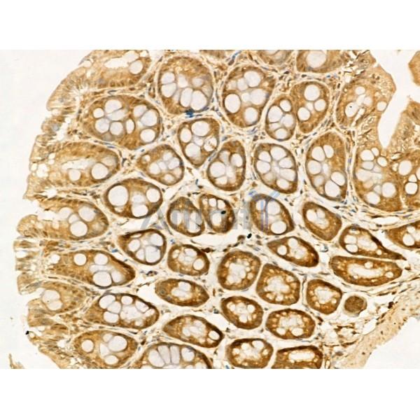 AMELX Antibody - DF13729 at 1/100 staining Mouse colorectal tissue by IHC-P.