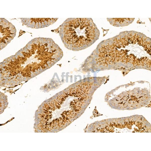 SCAMP2 Antibody - DF13731 at 1/100 staining Mouse testis tissue by IHC-P.