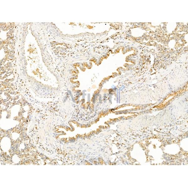SCAMP2 Antibody - DF13731 at 1/100 staining Rat lung tissue by IHC-P.