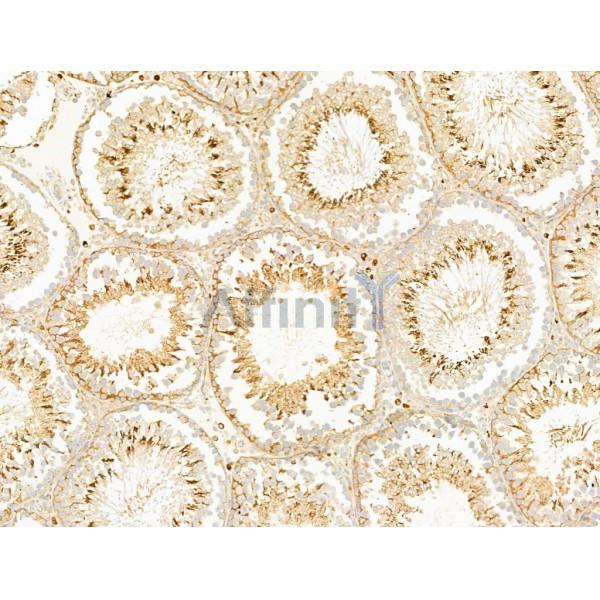 SCAMP2 Antibody - DF13731 at 1/100 staining Rat testis tissue by IHC-P.