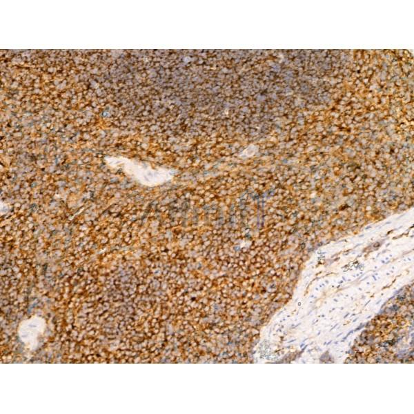 SCAMP2 Antibody - DF13731 at 1/100 staining Mouse spleen tissue by IHC-P.
