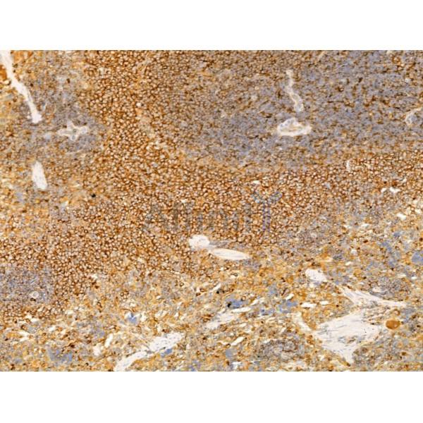 SCAMP2 Antibody - DF13731 at 1/100 staining Rat spleen tissue by IHC-P.