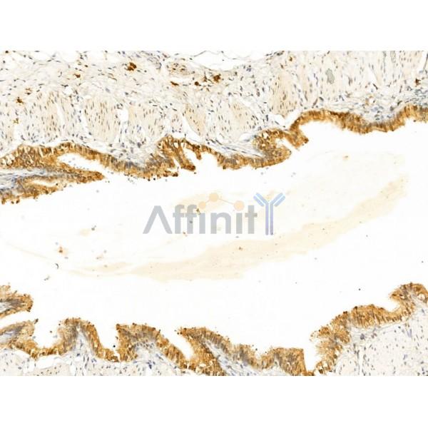 ECSIT Antibody - DF13748 at 1/100 staining Rat lung tissue by IHC-P.