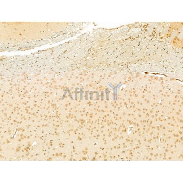 LHX6 Antibody - DF13749 at 1/100 staining Mouse brain tissue by IHC-P.
