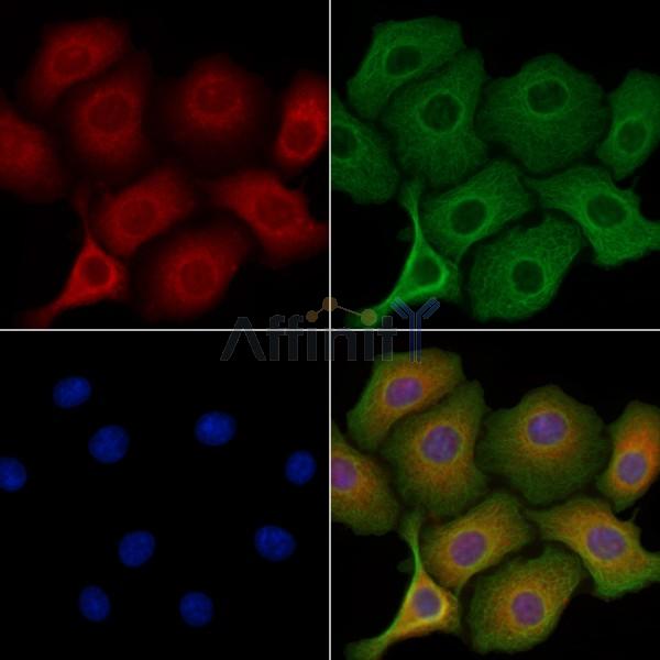 MAP4K2 Antibody - DF2336 staining Hela cells by IF/ICC.