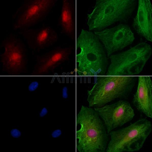 GADD45B Antibody - DF2375 staining A549 cells by IF/ICC.