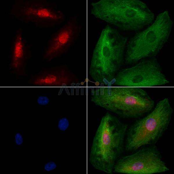 TBR1 Antibody - DF2396 staining A549 cells by IF/ICC.
