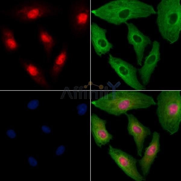 NUFIP2 Antibody - DF2420 staining A549 cells by IF/ICC.
