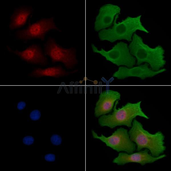 ZBTB33 Antibody - DF2423 staining Hela cells by IF/ICC.